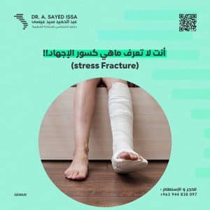 كسور الإجهاد